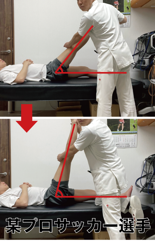 股関節の角度改善